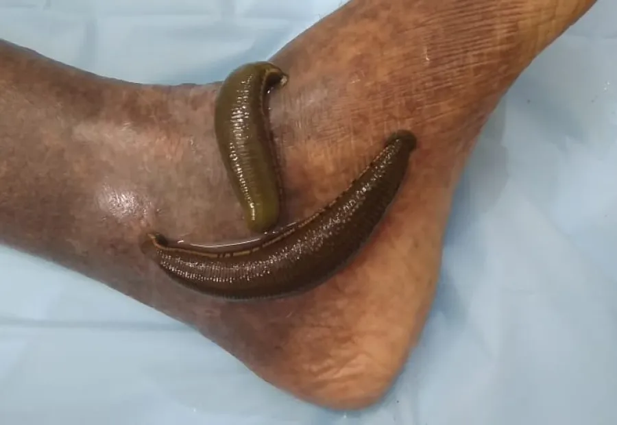 Dharshini recovery image 2